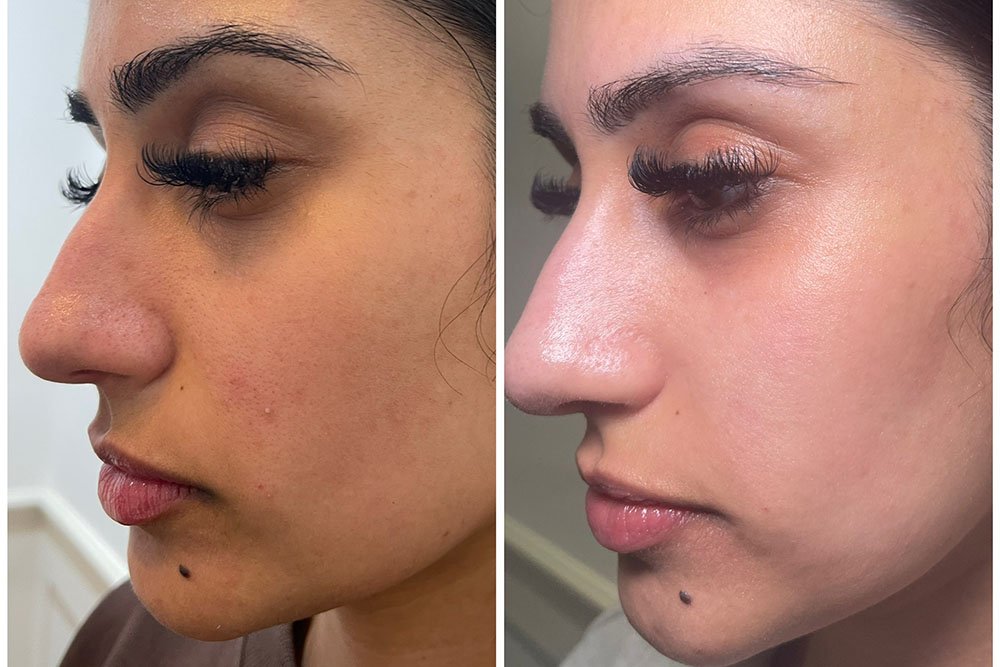 Skin-results-11