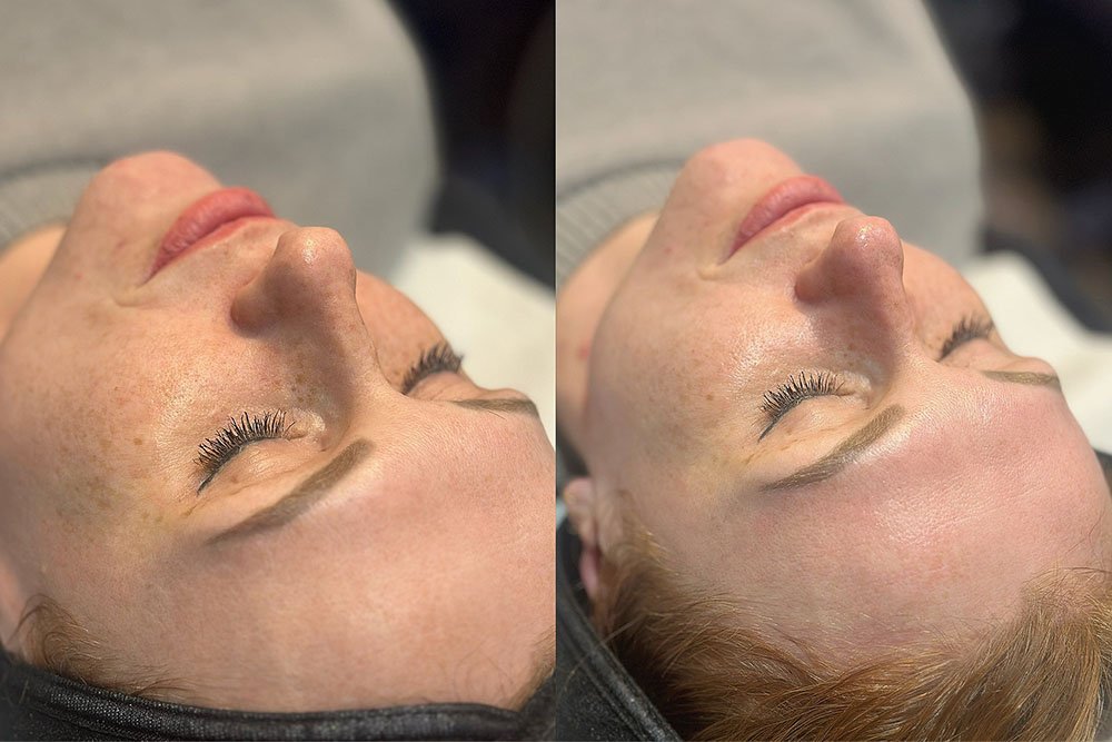 Skin-results-3