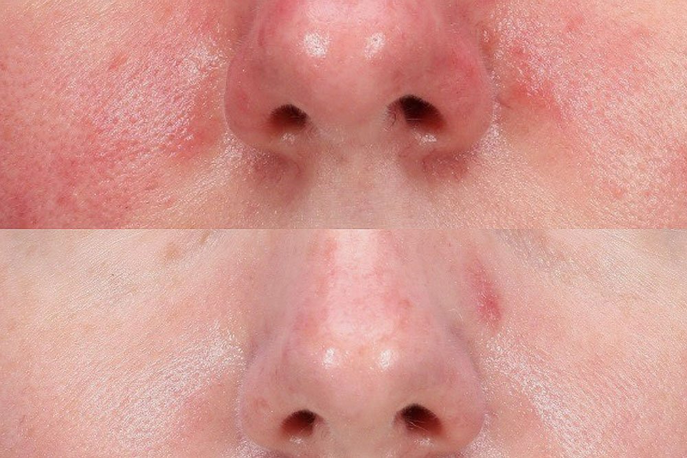 Skin-results9
