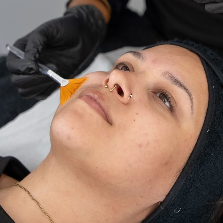New-perfect-peel