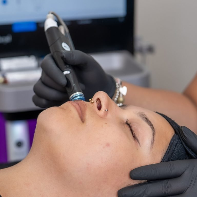 hydrafacial-2